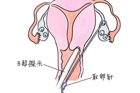 http://shenzhen.huochezhan.net/post/205.html|深圳供卵助孕