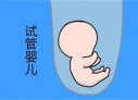 培养深圳捐卵宝宝艺术细胞的小技巧